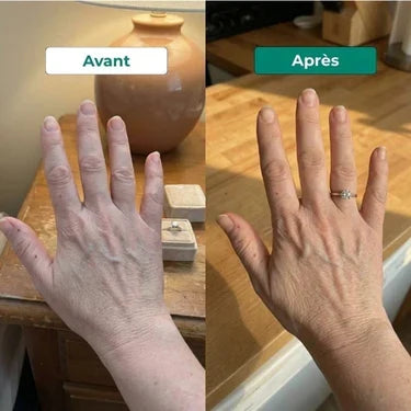 Résultat avant / après - main