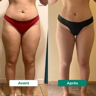 Résultat avant / après - jambes