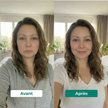 Résultat avant / après - visage