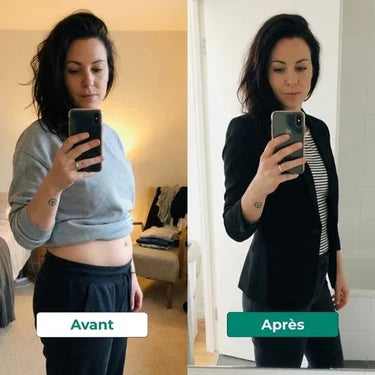 Résultat avant / après - ventre